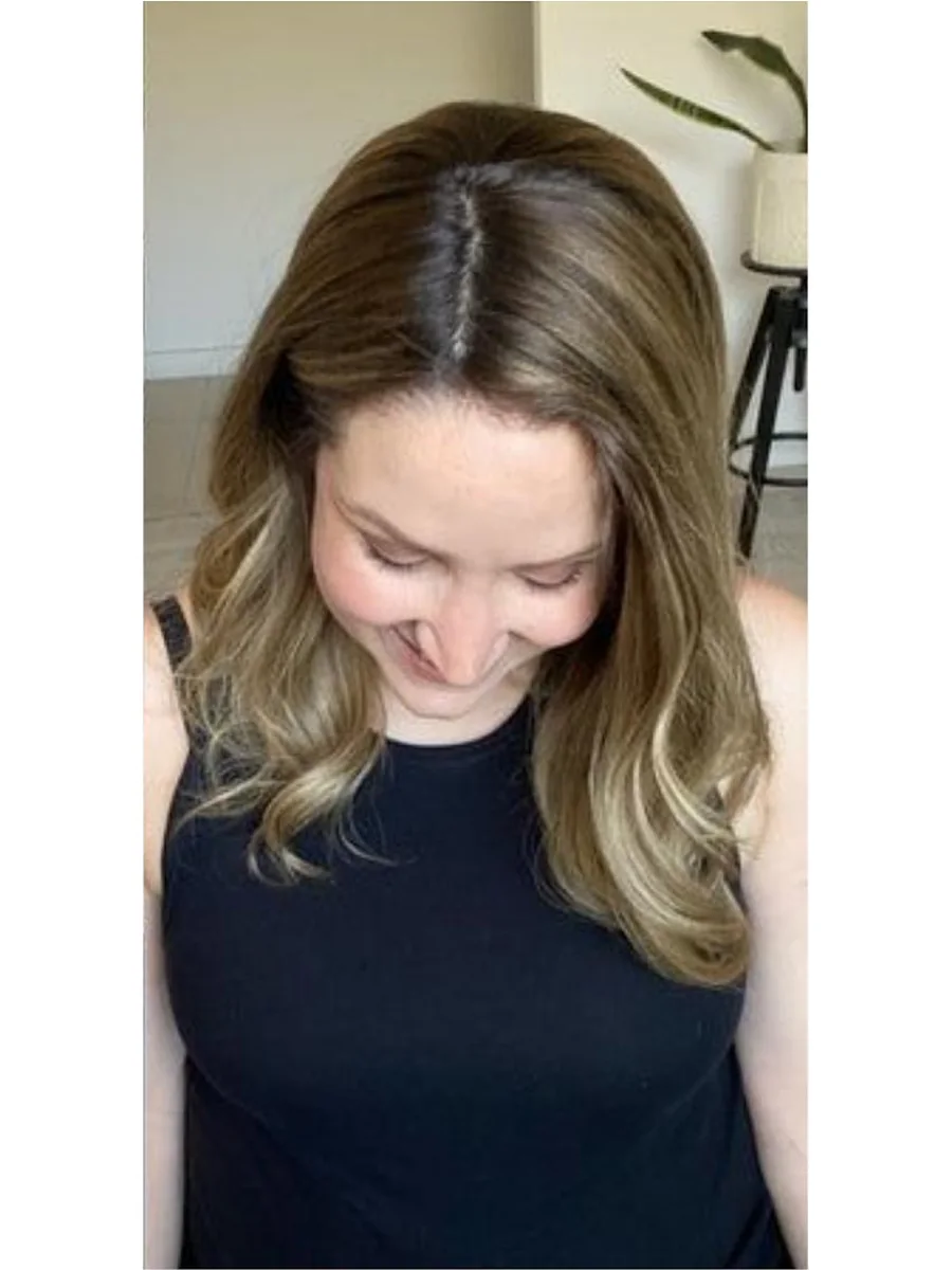 Hair Restoration after