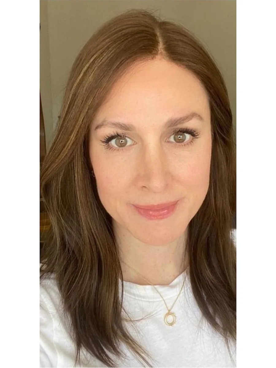 Hair Restoration after