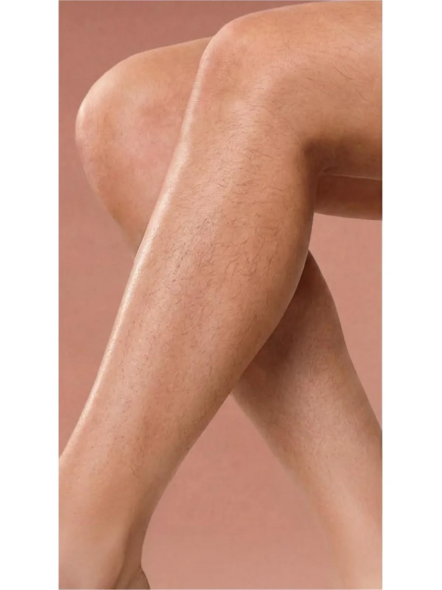 Laser Hair Removal before