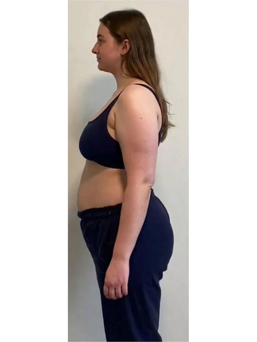 Medical Weight Loss before